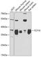 Transcription Factor 19 antibody, GTX16440, GeneTex, Western Blot image 