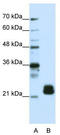 Transmembrane P24 Trafficking Protein 4 antibody, TA344030, Origene, Western Blot image 