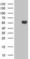 Leucine Rich Repeat Containing 6 antibody, LS-C798301, Lifespan Biosciences, Western Blot image 