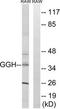 Gamma-Glutamyl Hydrolase antibody, TA314815, Origene, Western Blot image 