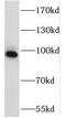 NOP2/Sun RNA Methyltransferase 2 antibody, FNab05870, FineTest, Western Blot image 