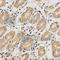 Propionyl-CoA Carboxylase Subunit Beta antibody, A5415, ABclonal Technology, Immunohistochemistry paraffin image 