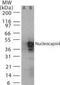 Influenza B Virus Nucleoprotein antibody, PA1-41276, Invitrogen Antibodies, Western Blot image 
