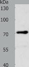 Proto-oncogene tyrosine-protein kinase Yes antibody, TA321714, Origene, Western Blot image 