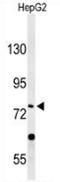 Phospholipase A2 Group VI antibody, AP53326PU-N, Origene, Western Blot image 