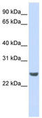 NFKB Inhibitor Interacting Ras Like 1 antibody, TA333741, Origene, Western Blot image 