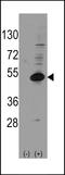 Nuclear receptor subfamily 0 group B member 1 antibody, LS-B9030, Lifespan Biosciences, Western Blot image 