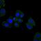 Homeostatic Iron Regulator antibody, A00506, Boster Biological Technology, Immunohistochemistry paraffin image 