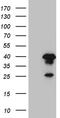 Zinc finger protein AEBP2 antibody, TA810263S, Origene, Western Blot image 