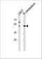 Solute Carrier Family 25 Member 25 antibody, A09109, Boster Biological Technology, Western Blot image 