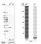 Catechol O-methyltransferase antibody, HPA001169, Atlas Antibodies, Western Blot image 