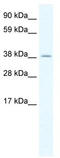Heat Shock Transcription Factor Y-Linked 2 antibody, TA329944, Origene, Western Blot image 