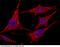 Interleukin 6 Signal Transducer antibody, 90275-T10, Sino Biological, Immunohistochemistry frozen image 