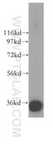 Serine/threonine-protein phosphatase 6 catalytic subunit antibody, 15852-1-AP, Proteintech Group, Western Blot image 
