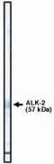 Activin A Receptor Type 1 antibody, PA1-12641, Invitrogen Antibodies, Western Blot image 