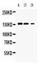 Janus Kinase 1 antibody, A00330, Boster Biological Technology, Western Blot image 