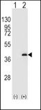 Protein Phosphatase 1 Catalytic Subunit Beta antibody, TA325036, Origene, Western Blot image 