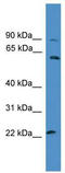 Potassium Voltage-Gated Channel Modifier Subfamily S Member 1 antibody, TA338531, Origene, Western Blot image 
