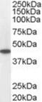 Acyl-CoA Dehydrogenase Medium Chain antibody, NB100-1121, Novus Biologicals, Western Blot image 