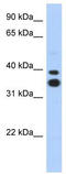 Msh Homeobox 2 antibody, TA329263, Origene, Western Blot image 