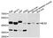 Natural Cytotoxicity Triggering Receptor 2 antibody, STJ22990, St John