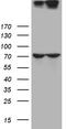 Nucleoporin 210 antibody, TA812297, Origene, Western Blot image 