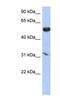 Cytochrome P450 4X1 antibody, NBP1-62382, Novus Biologicals, Western Blot image 