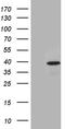 Translocase Of Outer Mitochondrial Membrane 40 Like antibody, CF810685, Origene, Western Blot image 