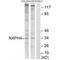 Neurexophilin 4 antibody, A16162, Boster Biological Technology, Western Blot image 