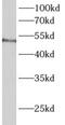 Aldehyde Dehydrogenase 3 Family Member B1 antibody, FNab00294, FineTest, Western Blot image 