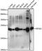 Eukaryotic Translation Elongation Factor 1 Epsilon 1 antibody, A08532, Boster Biological Technology, Western Blot image 
