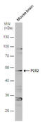 Purinergic Receptor P2X 2 antibody, GTX119003, GeneTex, Western Blot image 