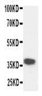 Kallikrein-5 antibody, PA1630, Boster Biological Technology, Western Blot image 