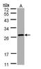 Secretion Associated Ras Related GTPase 1B antibody, PA5-28951, Invitrogen Antibodies, Western Blot image 
