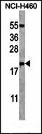 RNS3 antibody, orb31642, Biorbyt, Western Blot image 