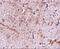 Translocase Of Outer Mitochondrial Membrane 70 antibody, A09172, Boster Biological Technology, Immunohistochemistry paraffin image 