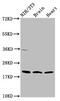 NADH:Ubiquinone Oxidoreductase Subunit B8 antibody, CSB-PA015655LA01HU, Cusabio, Western Blot image 