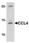 C-C Motif Chemokine Ligand 4 antibody, PA5-34509, Invitrogen Antibodies, Western Blot image 