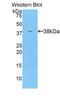 Keratin 71 antibody, LS-C301203, Lifespan Biosciences, Western Blot image 