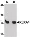 T-cell surface glycoprotein YE1/48 antibody, PA5-20675, Invitrogen Antibodies, Western Blot image 