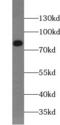 Junction Plakoglobin antibody, FNab03334, FineTest, Western Blot image 