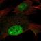 Zinc Finger Protein 606 antibody, NBP2-54926, Novus Biologicals, Immunofluorescence image 