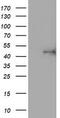 ALG2 Alpha-1,3/1,6-Mannosyltransferase antibody, M06556, Boster Biological Technology, Western Blot image 