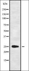 Centrosomal Protein 72 antibody, orb338161, Biorbyt, Western Blot image 