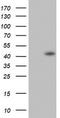 Caudal Type Homeobox 2 antibody, TA802531BM, Origene, Western Blot image 