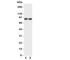 Neurotrophic Receptor Tyrosine Kinase 1 antibody, R31269, NSJ Bioreagents, Western Blot image 