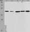 Acetyl-CoA Acyltransferase 2 antibody, TA321745, Origene, Western Blot image 