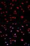 Jun Proto-Oncogene, AP-1 Transcription Factor Subunit antibody, AP0049, ABclonal Technology, Western Blot image 
