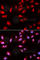 3-Phosphoinositide Dependent Protein Kinase 1 antibody, A1665, ABclonal Technology, Immunofluorescence image 