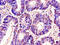 RNA 2',3'-Cyclic Phosphate And 5'-OH Ligase antibody, CSB-PA897546LA01HU, Cusabio, Immunohistochemistry frozen image 